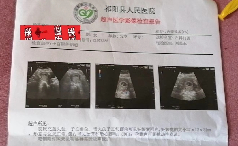北京幸孕星试管婴儿